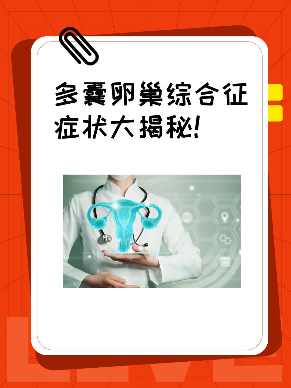 关于卵巢多囊综合征_关于多囊卵巢综合征的特点  第2张