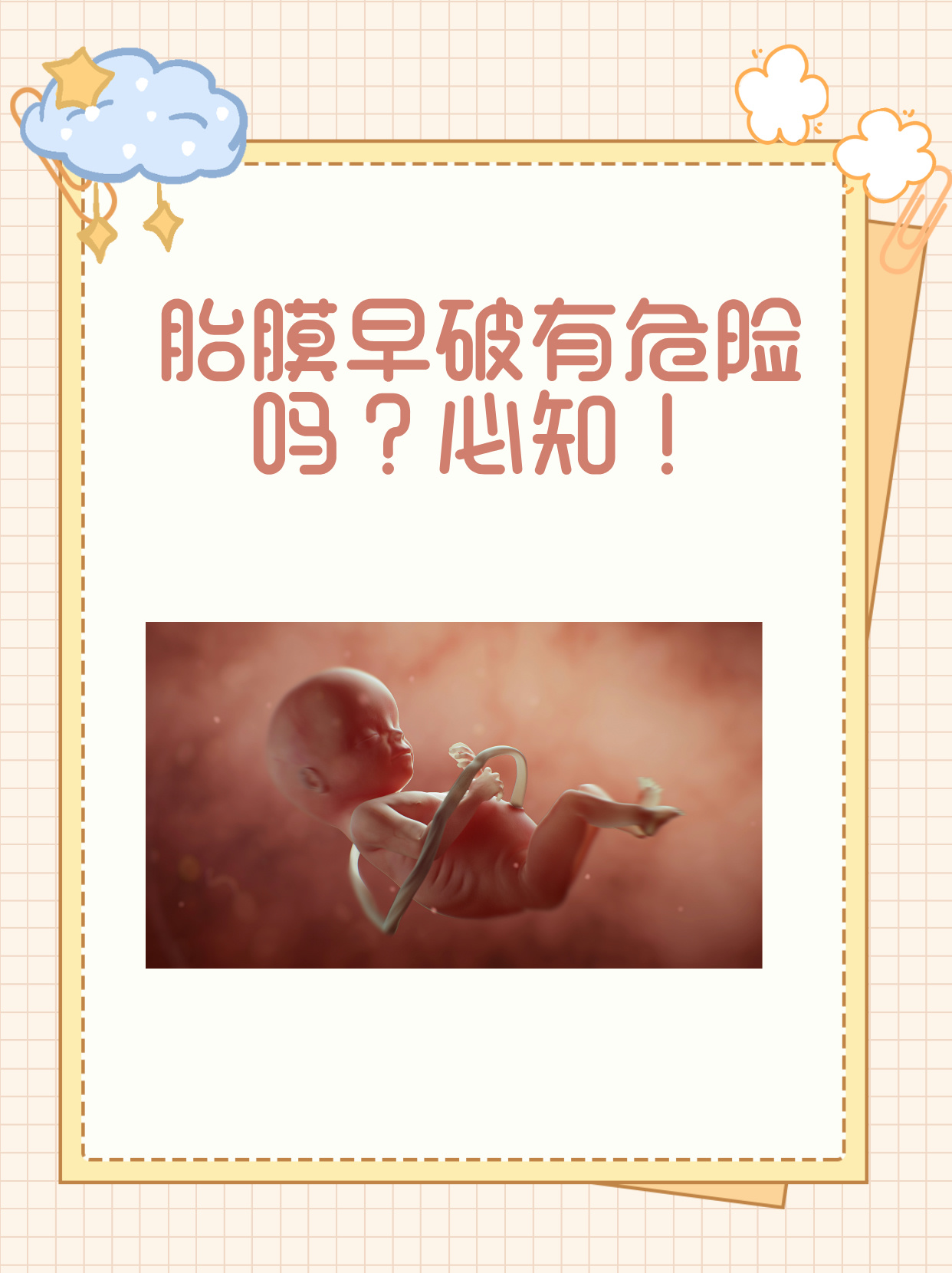 脱膜可能问题胎宝宝在肚子里羊膜包着胎盘和脐带怎么胎膜早破有危险吗