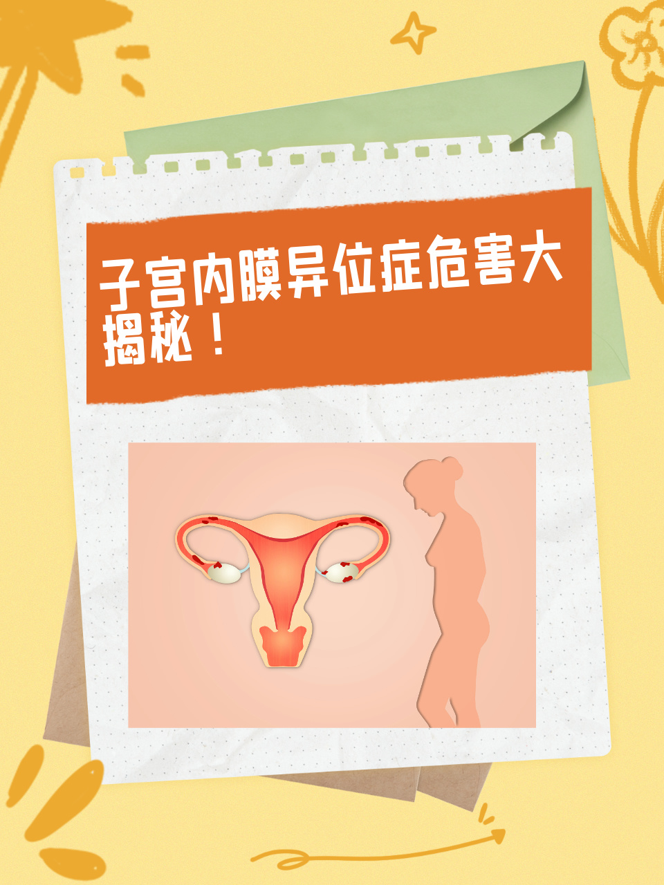 子宫内膜炎能移植胚胎吗(子宫内膜炎有移植成功的吗)  第2张