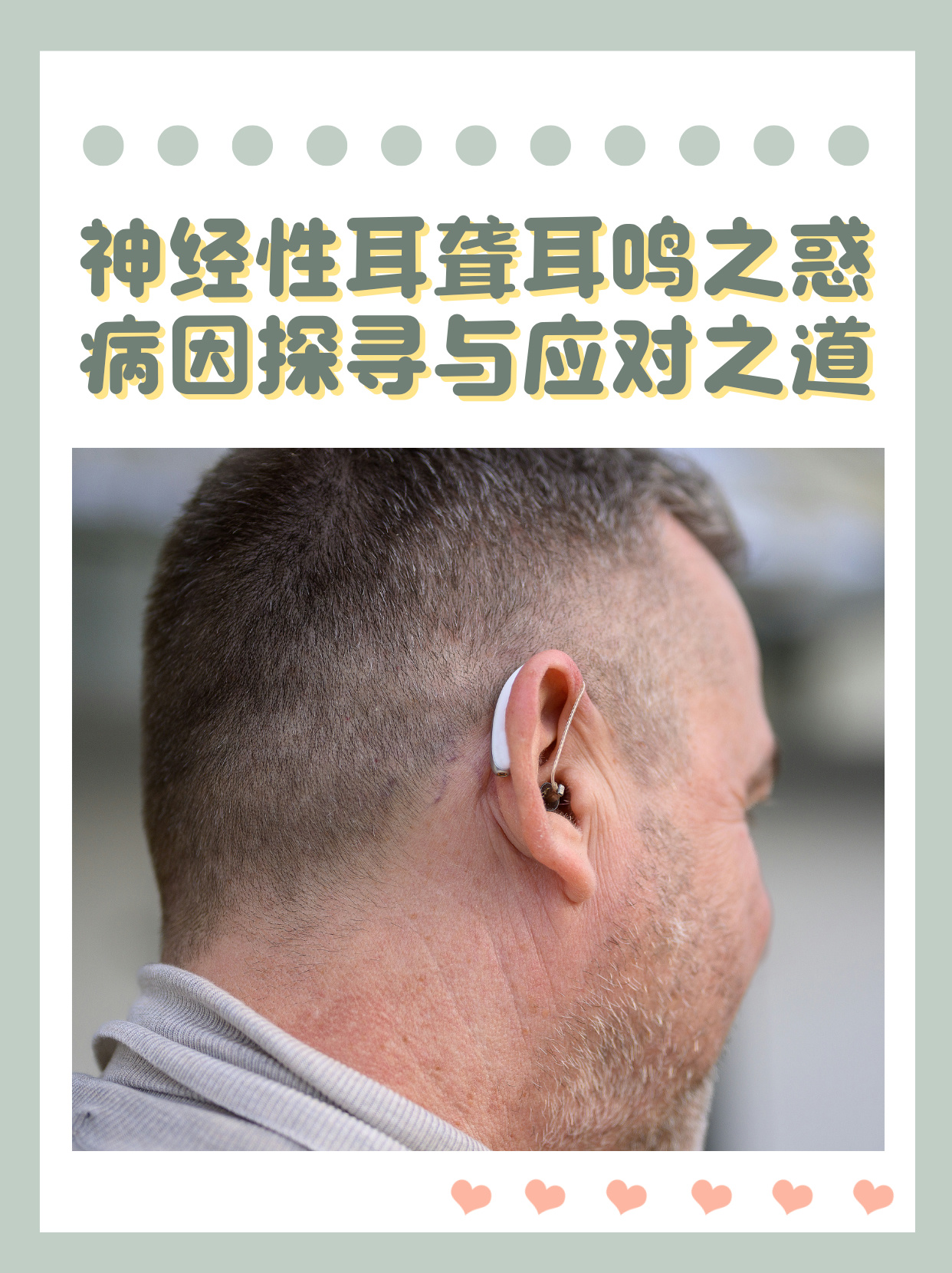 神经性耳聋耳鸣之惑病因探寻与应对之道