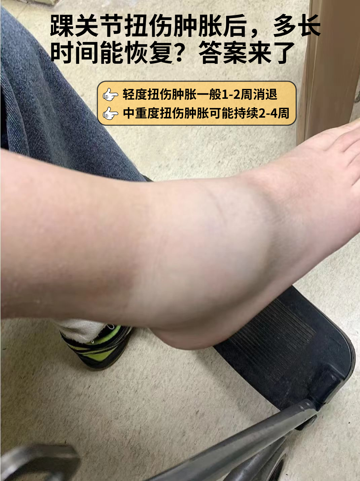 答案来了  踝关节扭伤肿胀后,多长时间能恢复是很多朋友关心的话题