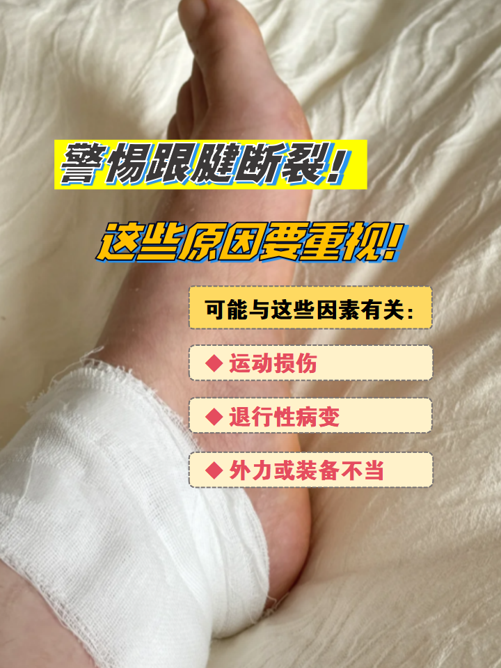 作为人体最粗壮的肌腱,跟腱断裂后恢复周期长,严重影响行动能力