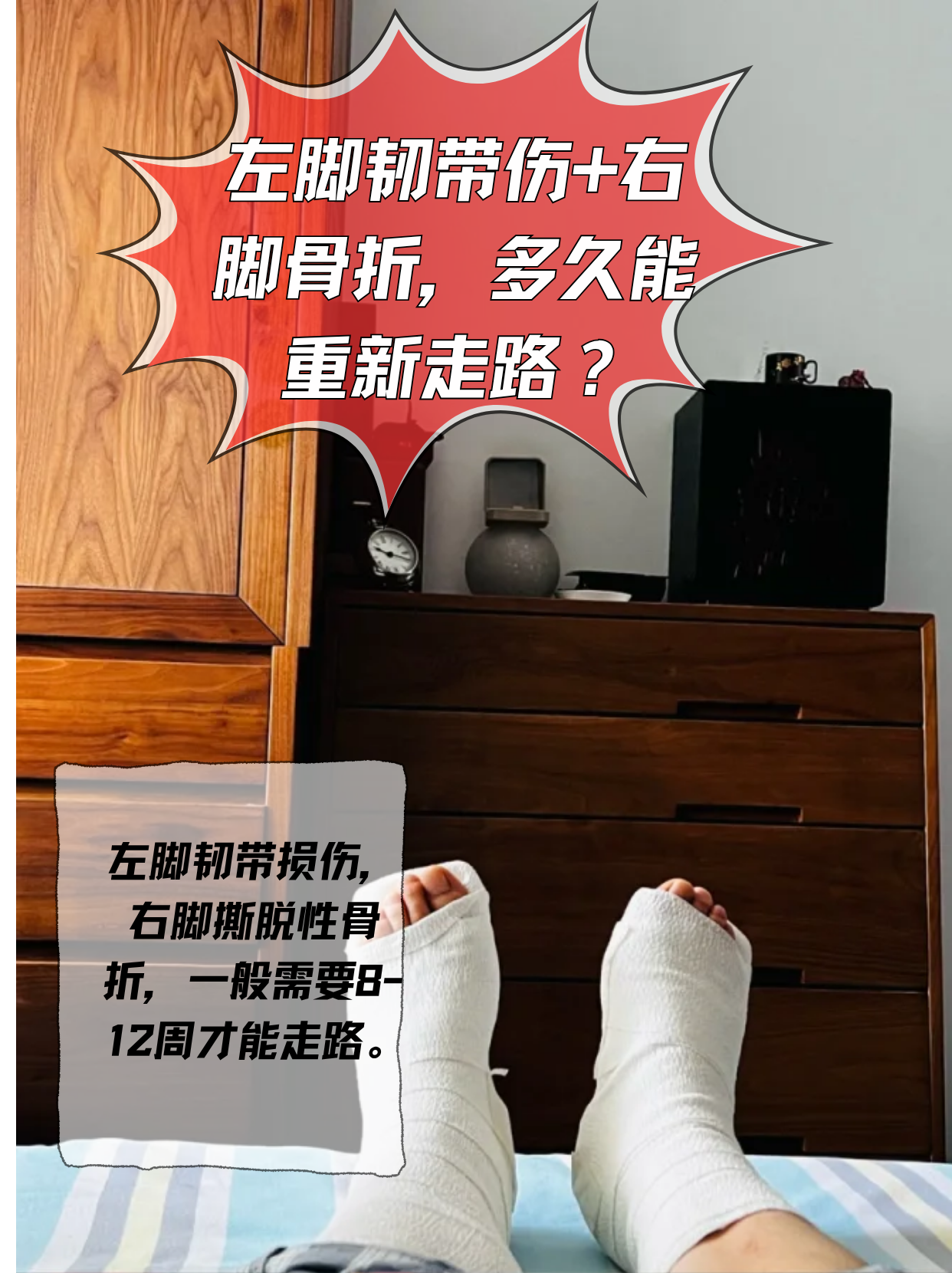 左脚韧带伤 右脚骨折,多久能重新走路?