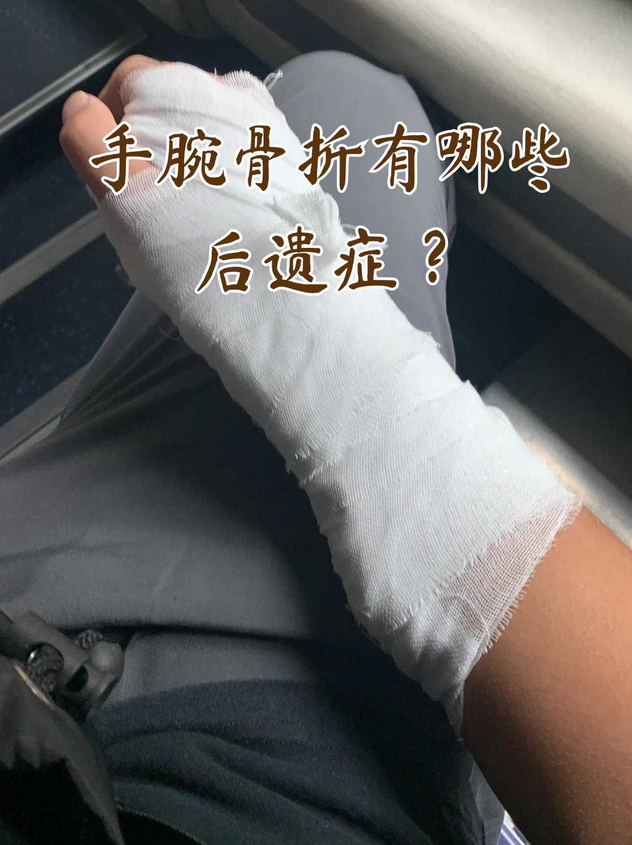 手腕骨折看似愈合后,其实暗藏的健康隐患可能悄悄影响日常生活