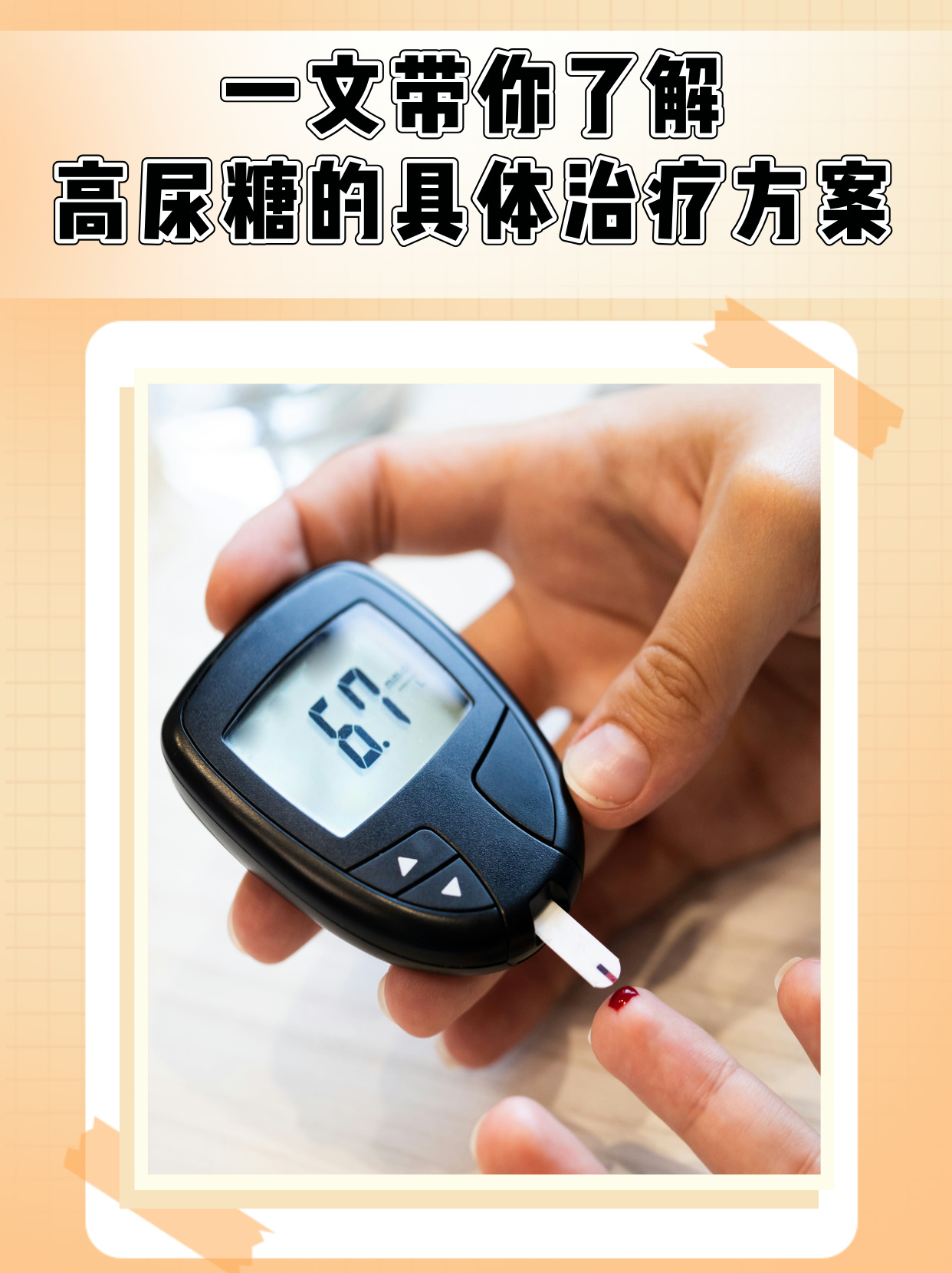 一文带你了解高尿糖的具体治疗方案 高尿糖即尿液