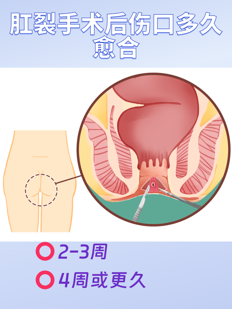 肛裂会自己愈合吗图片