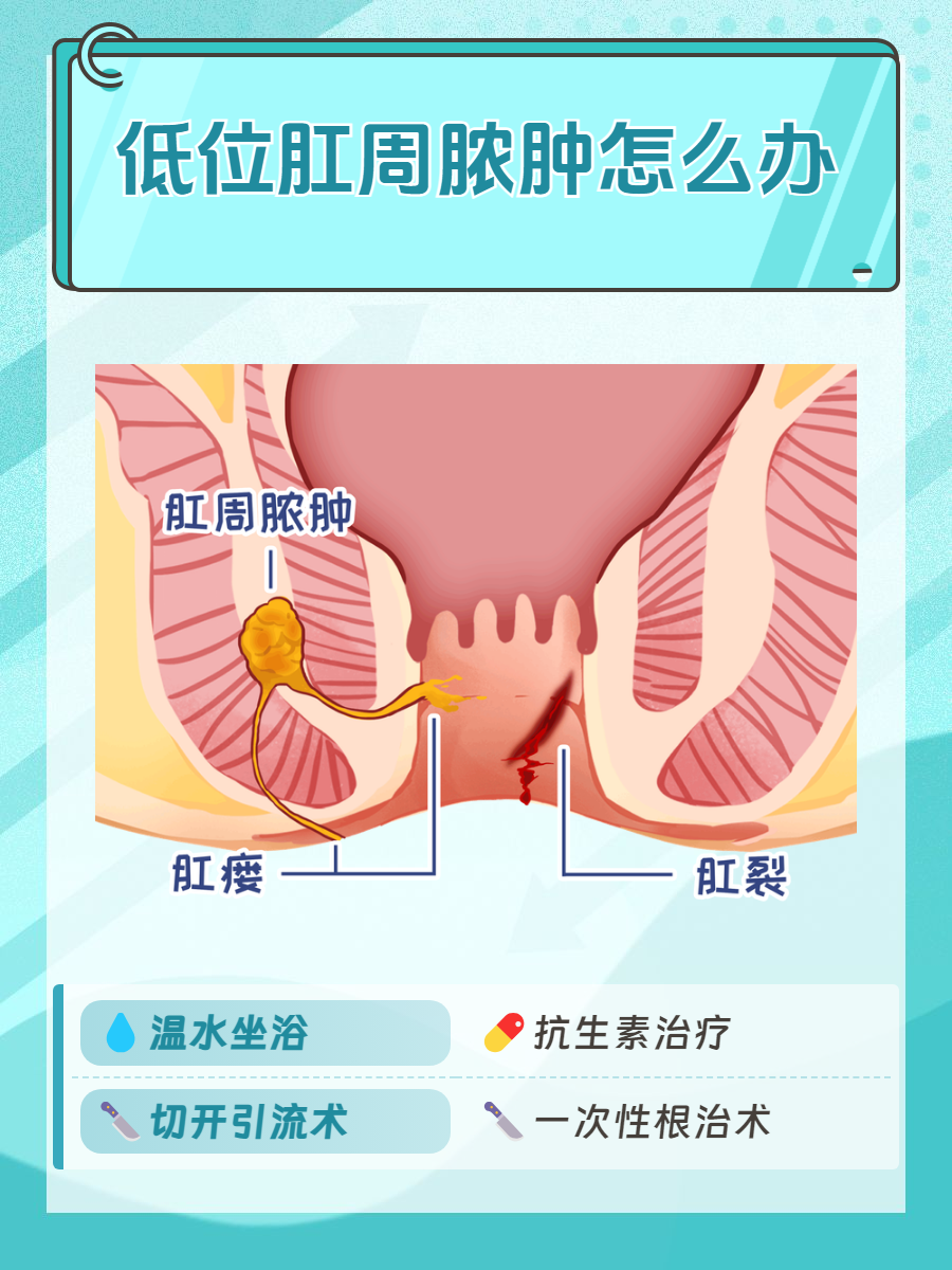 肛门直肠周围脓肿图片