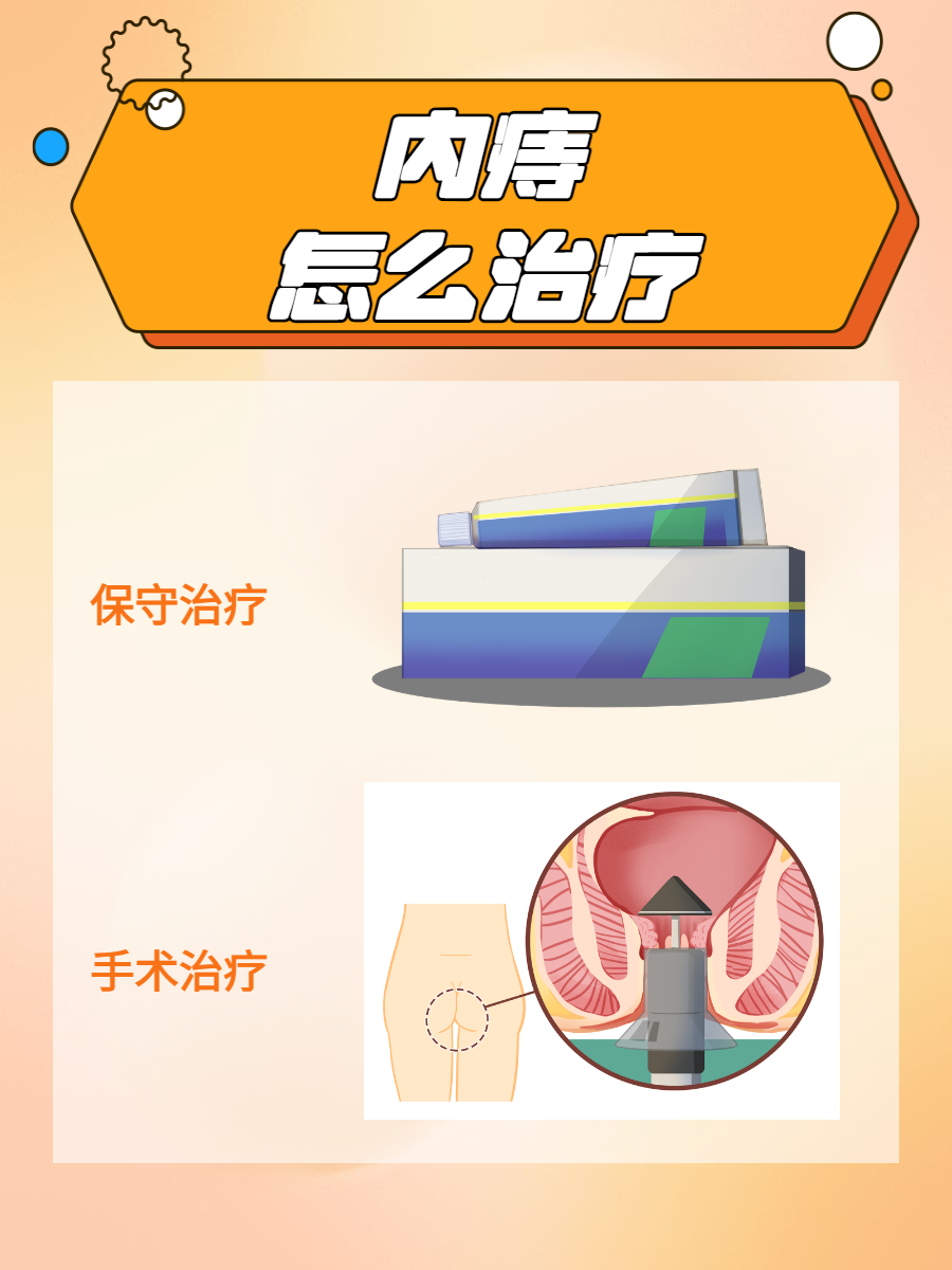 内痔的治疗方法多样,下面为大家详细说说内痔的治疗相关内容