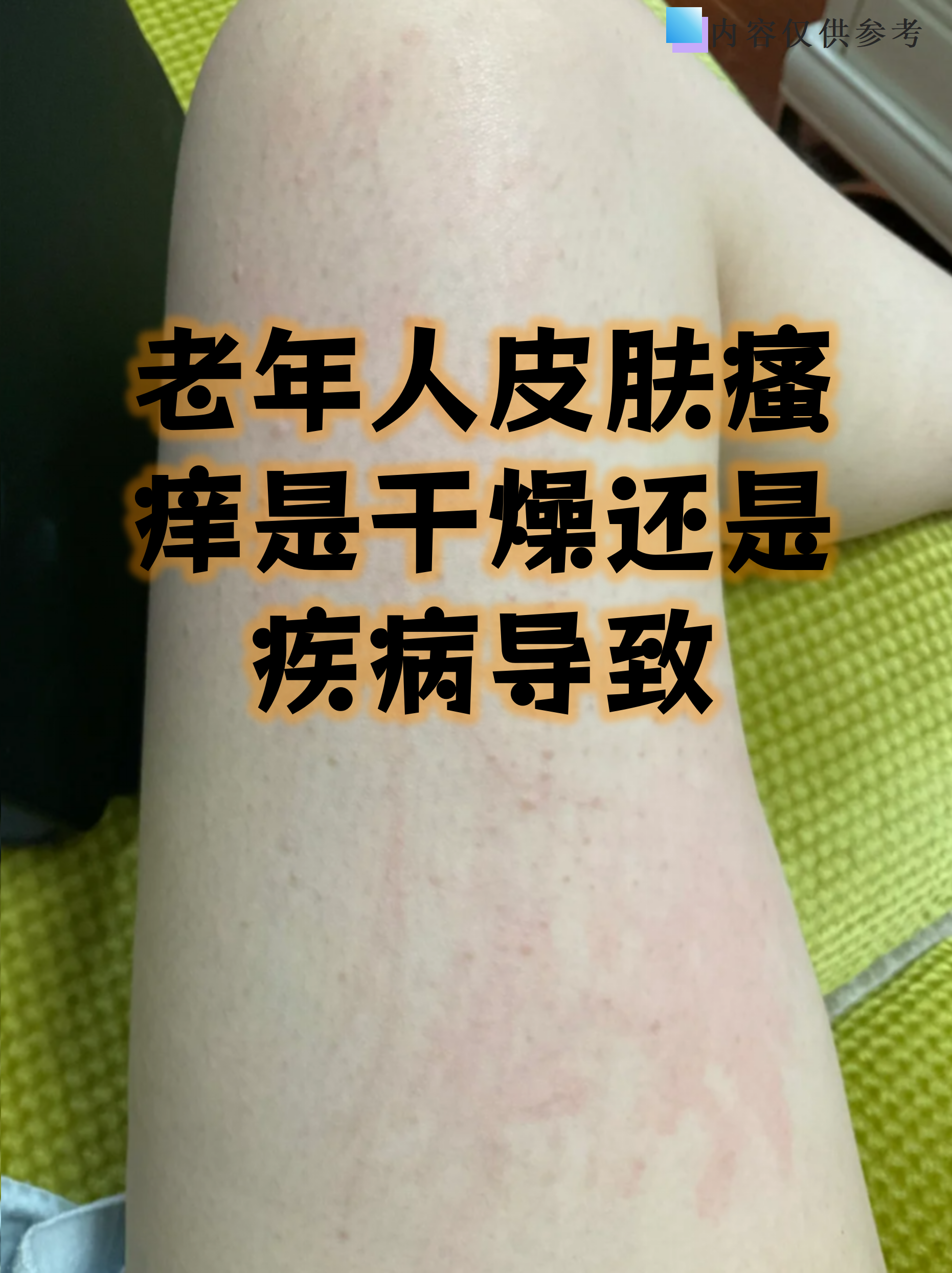 结痂为什么会很痒