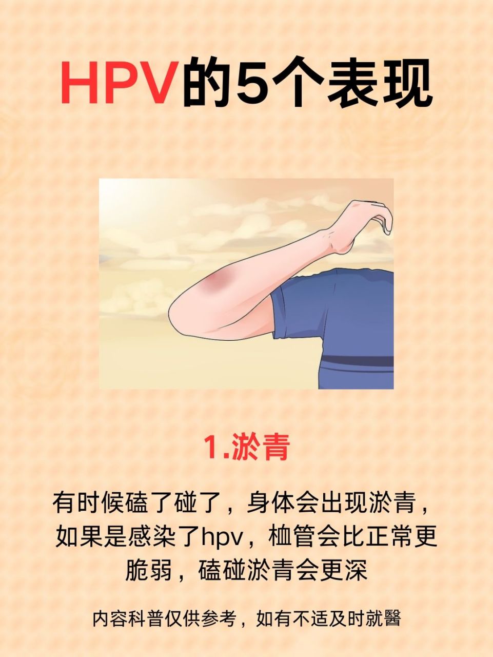 hpv#  的 5 个 表 xian