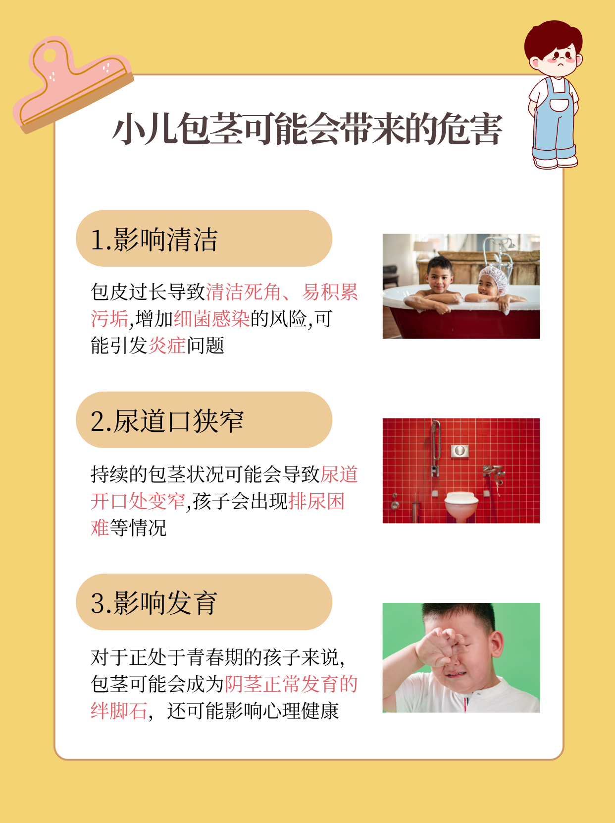 包茎,即包皮过长且不能完全翻起,覆盖住龟头