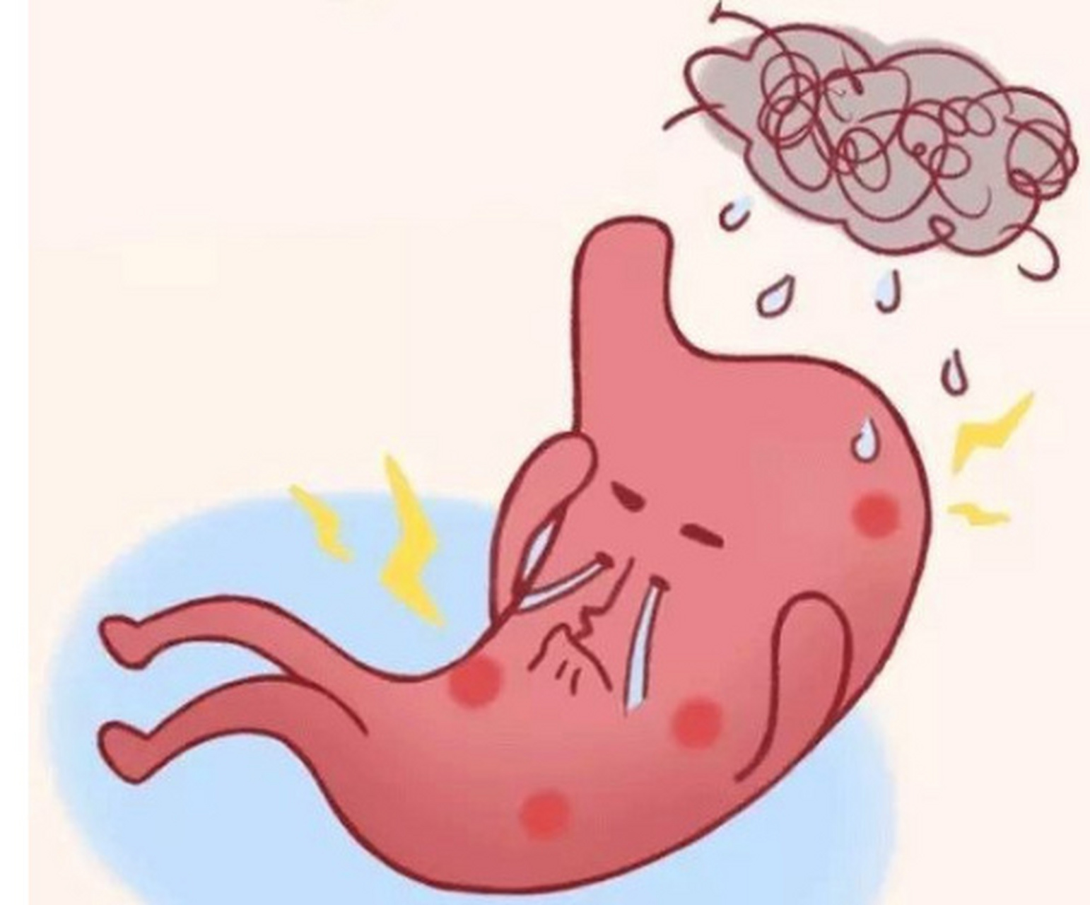 胆汁反流性胃炎的治疗和生活注意事项  胆汁反流性胃炎是指胆汁反流入