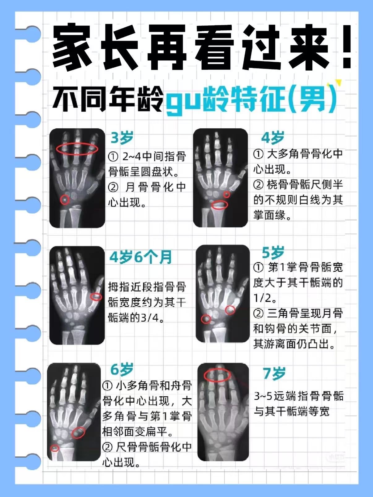  骨龄偏大或偏小一岁左右在临床上都可能属于正常范围