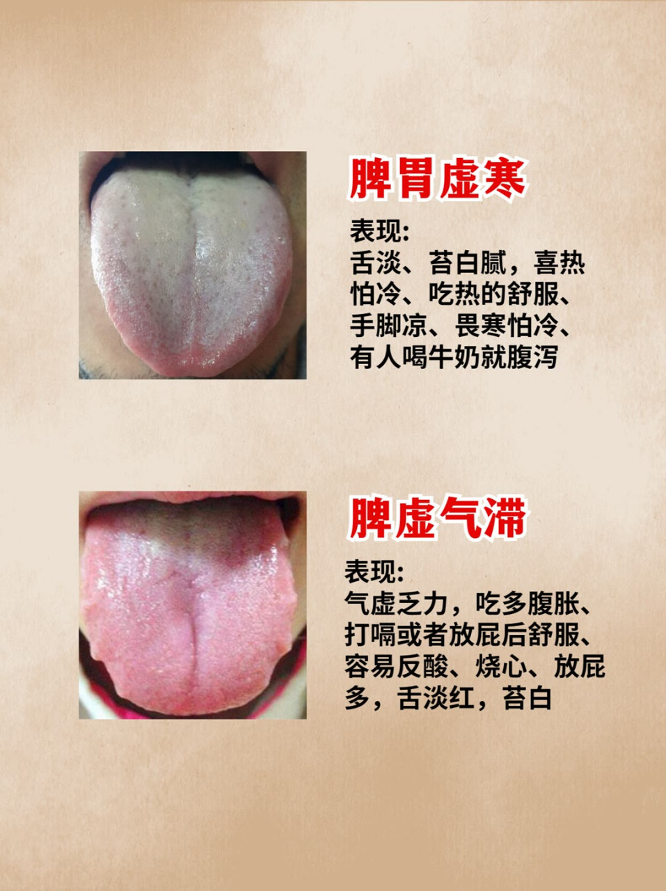 中医# #舌苔#  #脾虚