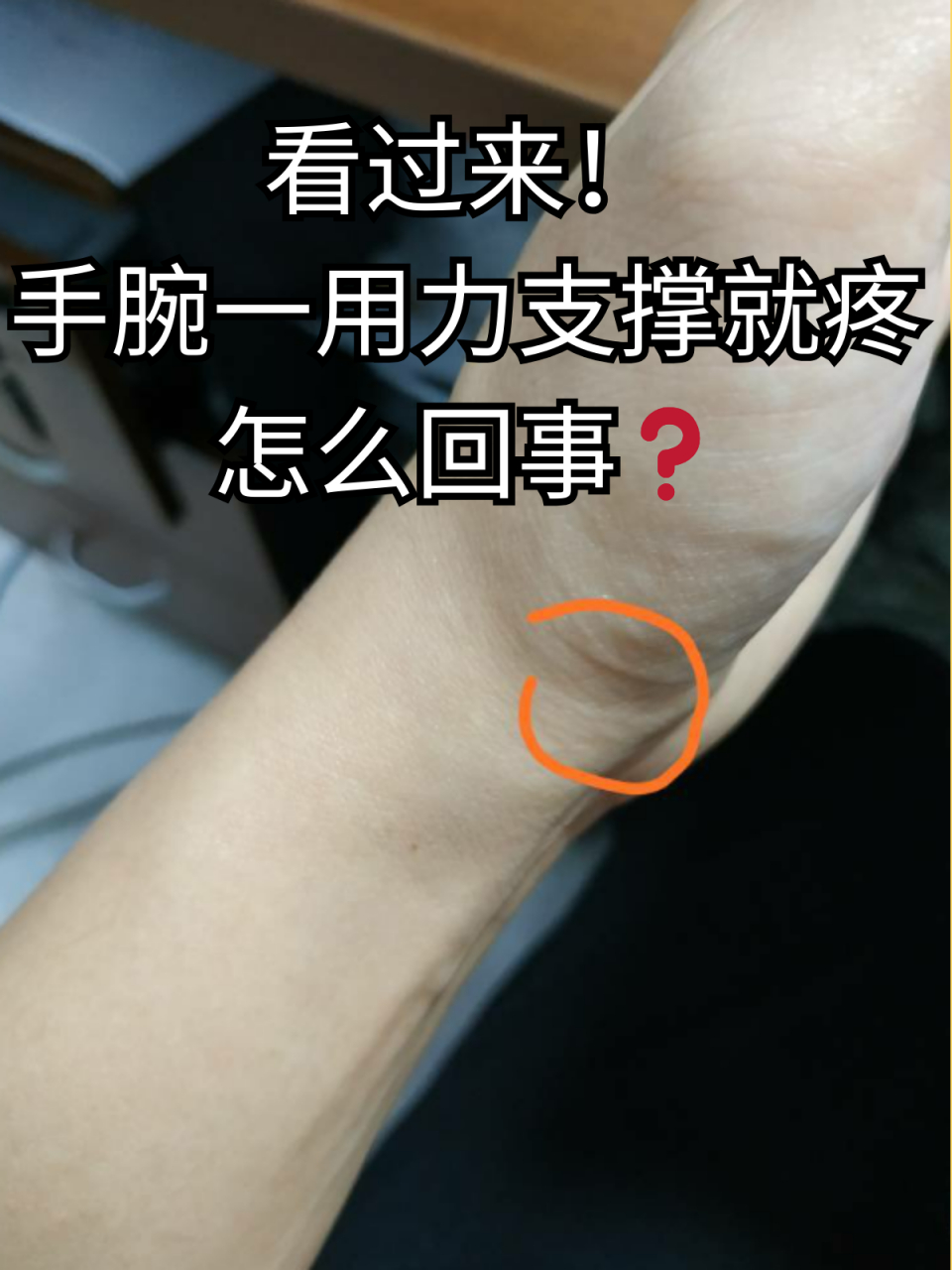手腕一用力支撑就疼怎么回事❓ 在平时生活中,大家可能会发现身体