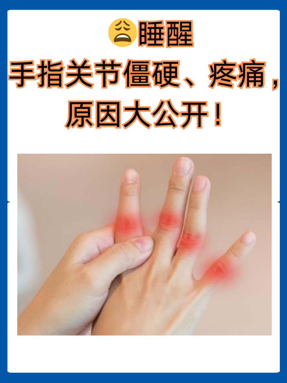07睡醒手指关节僵硬,疼痛,原因大公开!