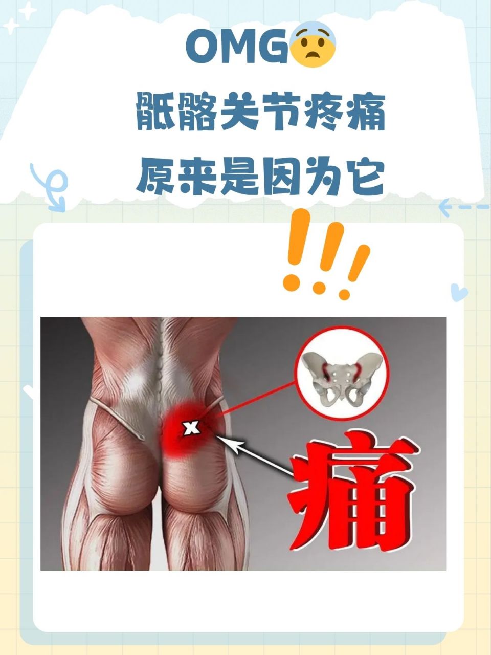 究竟是什么在背后作祟,引发了这种疼痛呢,又该如何解决呢❓相信大家