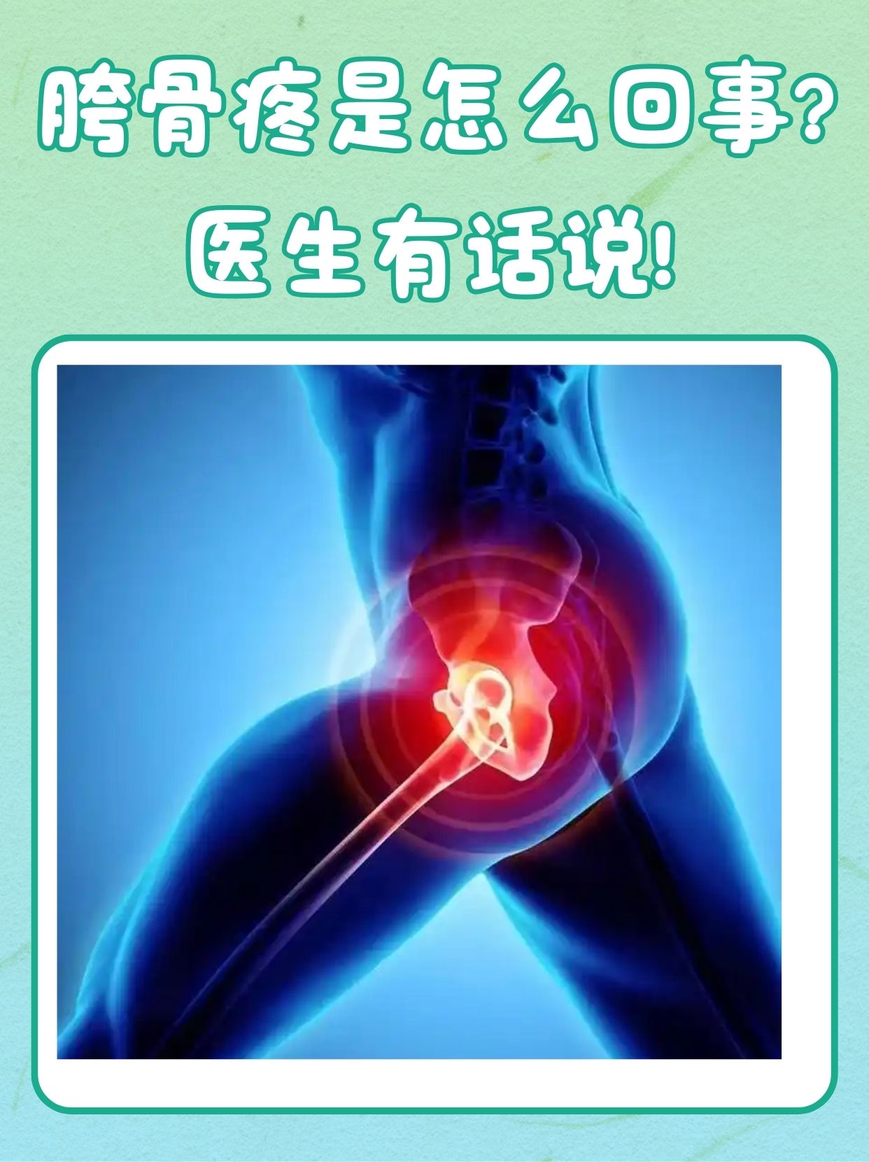 通常胯骨疼痛可能由多种因素引发,比较常见的如下所示: 长