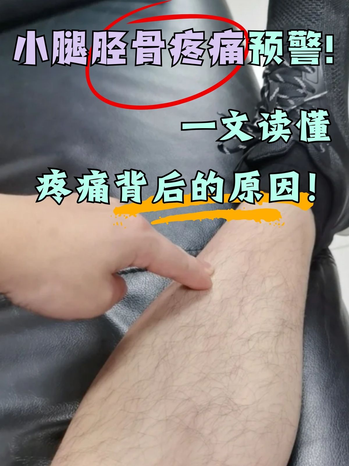 为什么小腿有肌肉