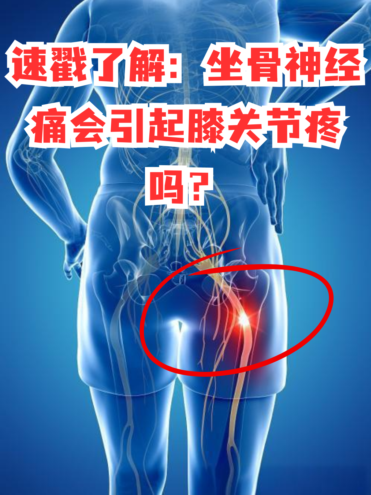 为什么会神经痛 为什么会神经痛