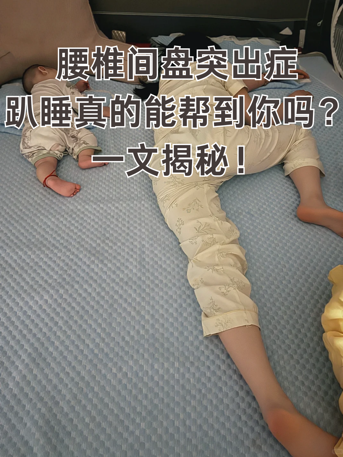 很多人都好奇,趴着睡对腰椎间盘突出症到底有没有好