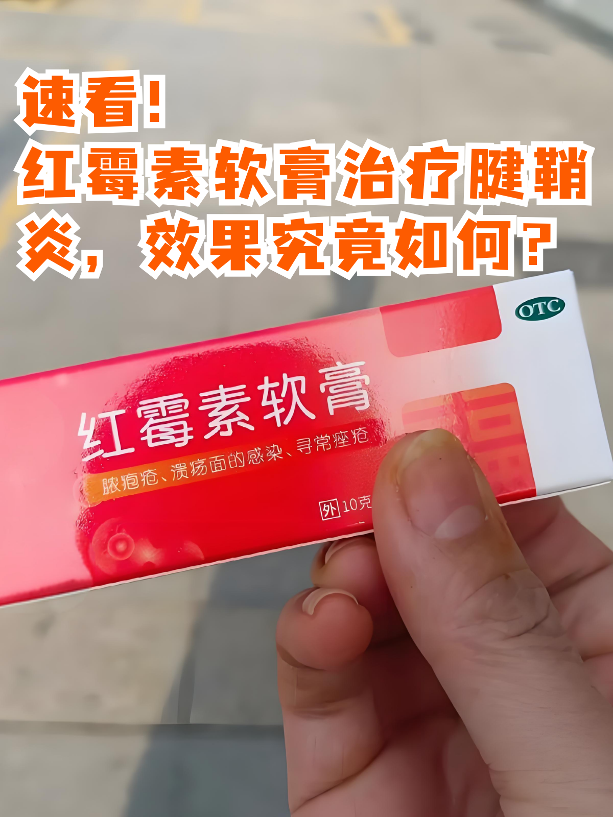 红霉素软膏治疗腱鞘炎,效果究竟如何?