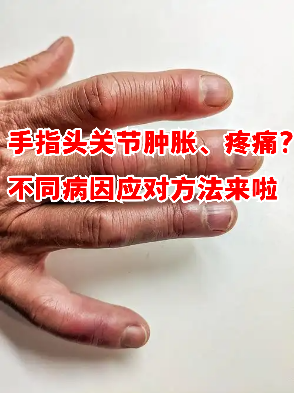 手指头关节肿胀,疼痛?