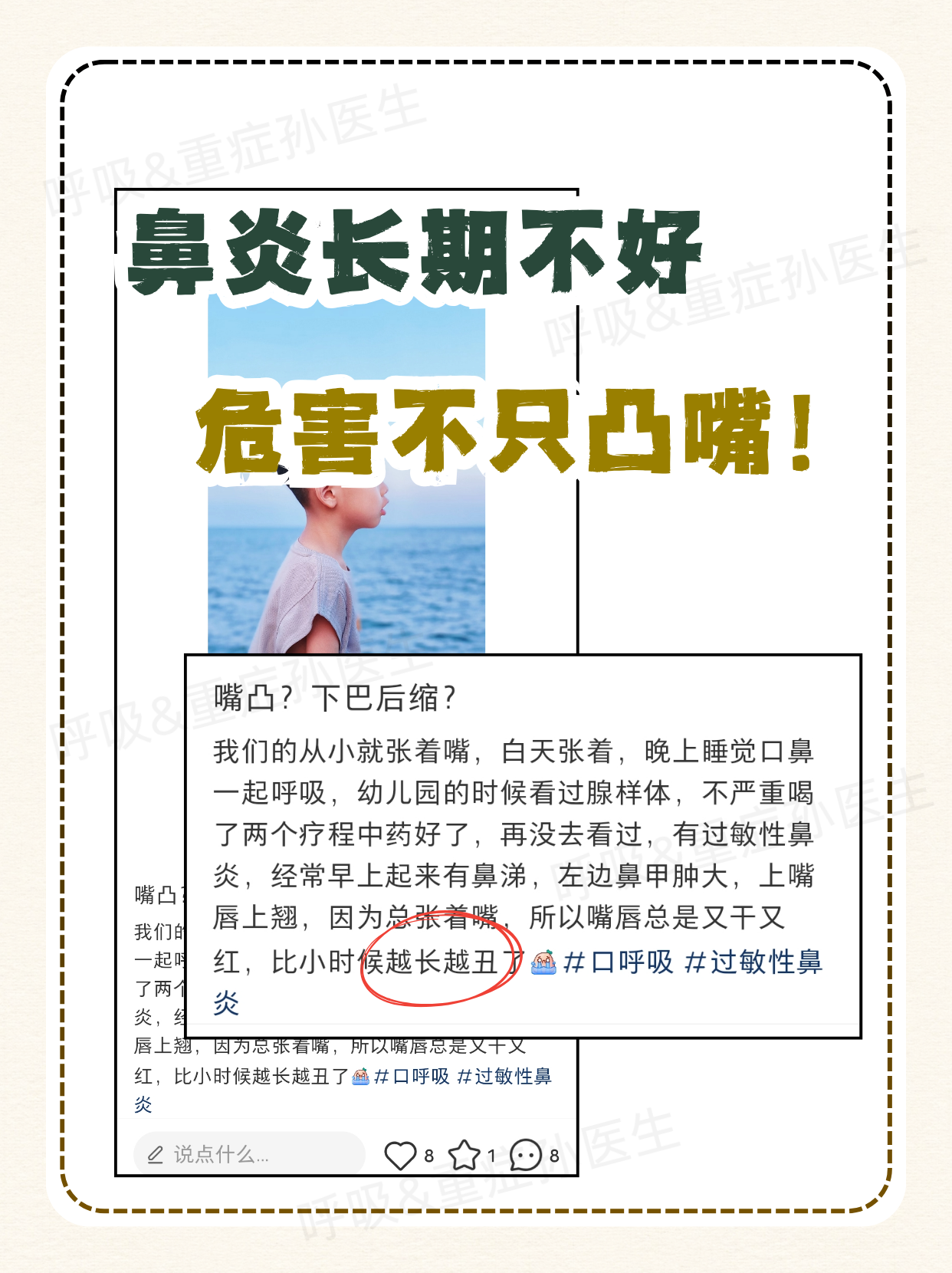 为什么会得鼻炎
