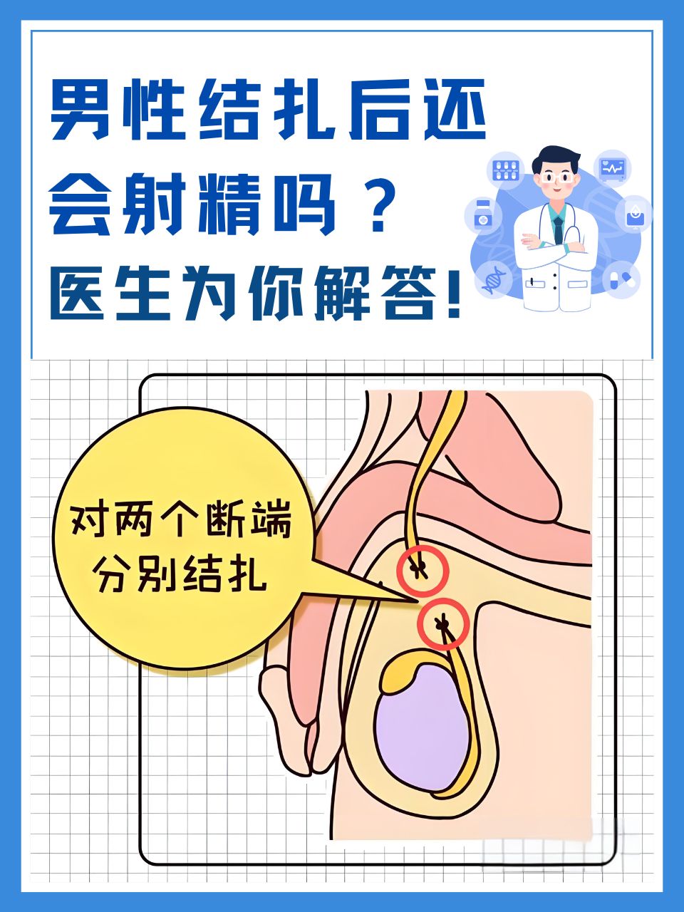 结扎图片 男人图片