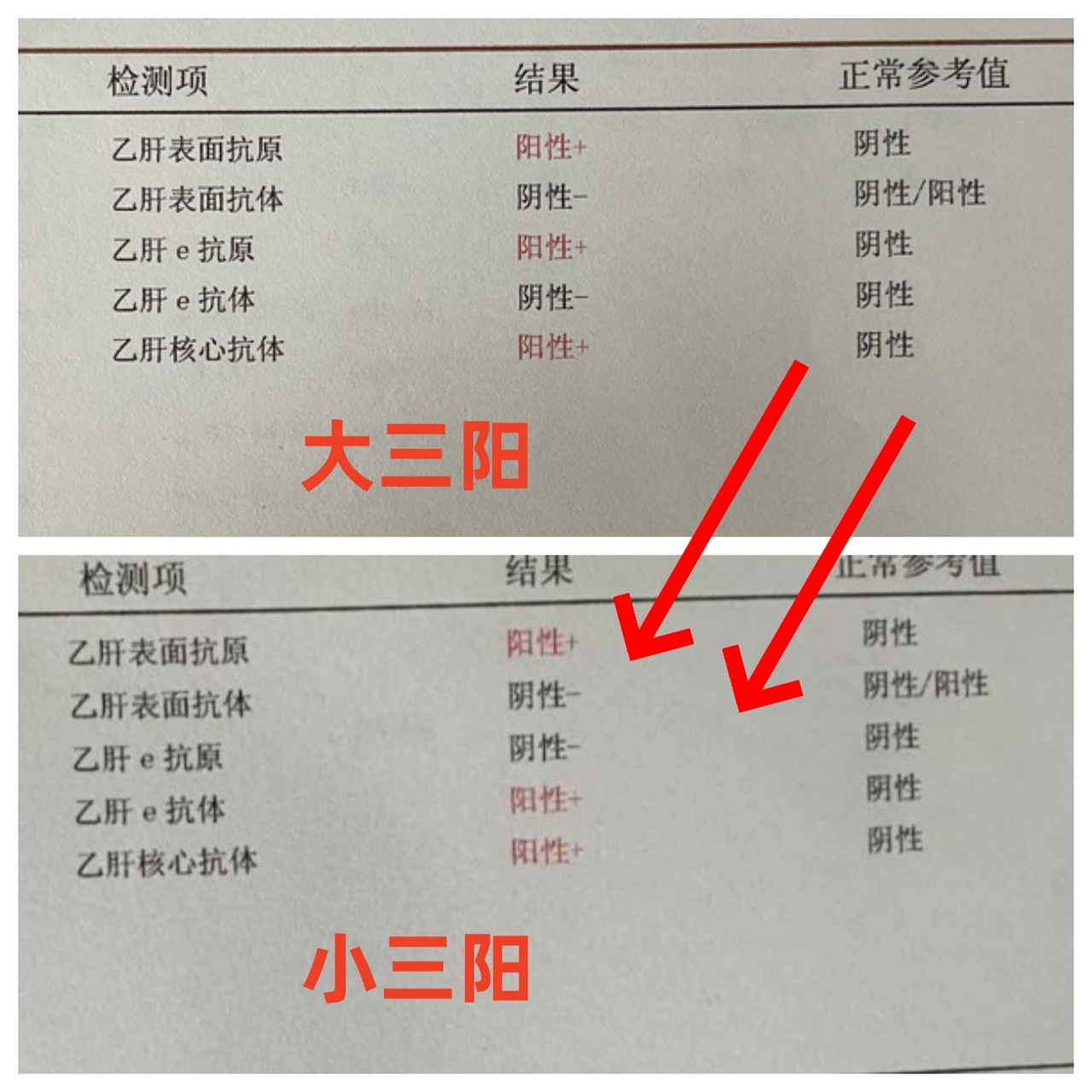 小三阳化验单正常图片