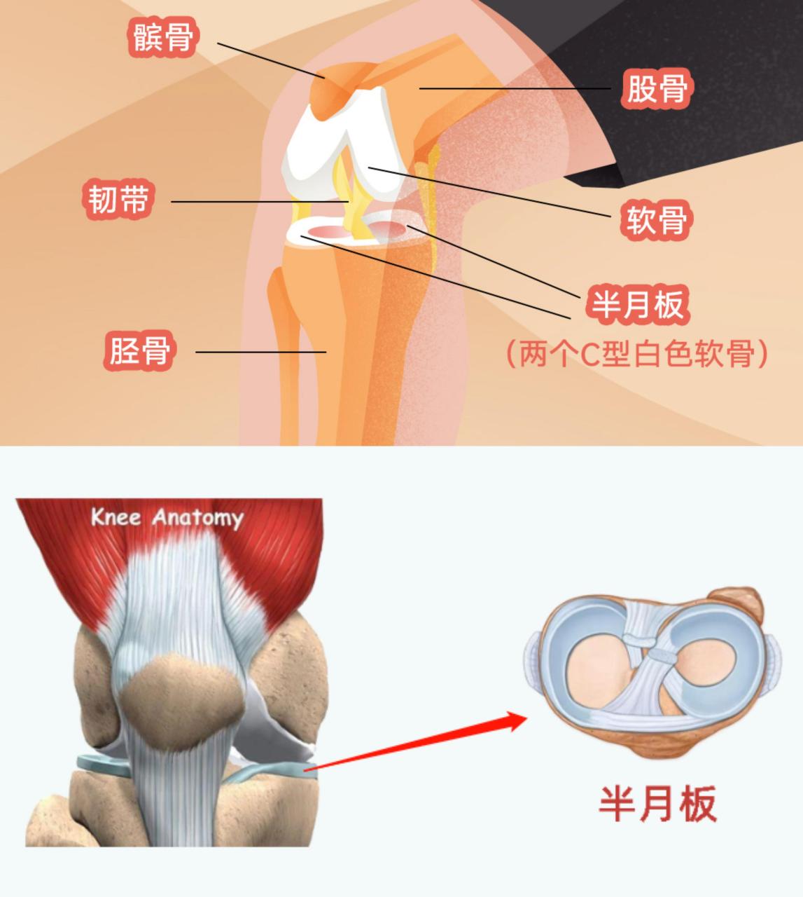 半月板疼痛位置图片图片