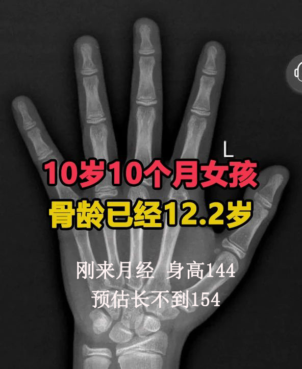 这些孩子长不高,真是太可惜了.