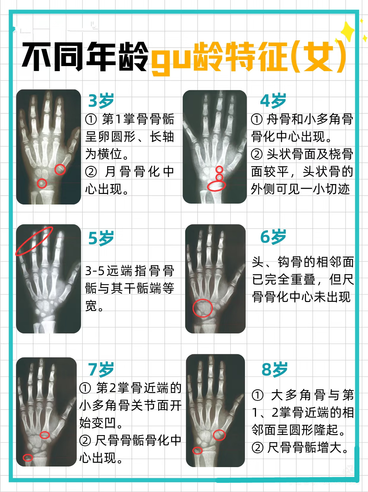 骨龄=发育年龄和实际年龄核能不同是
