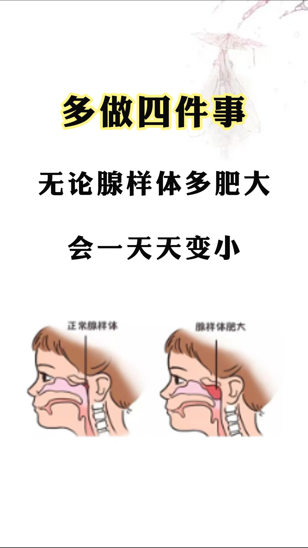 无论腺样体肥大堵塞多少 会一天天变小