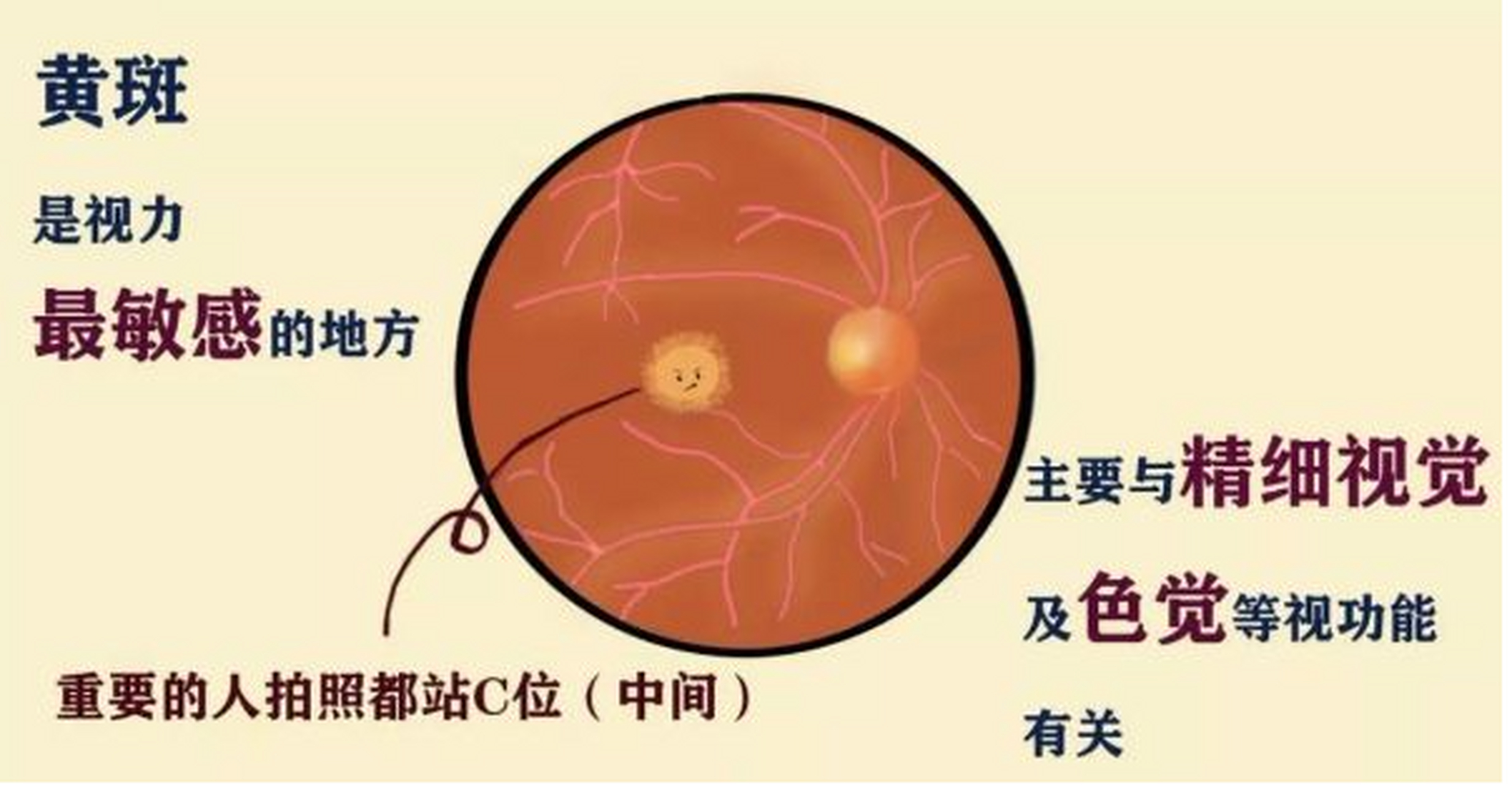 羟氯喹眼底病变图片