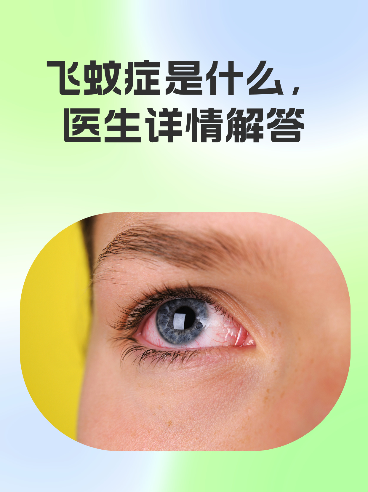 请问眼睛为什么有飞蚊出现百科在线 请问眼睛为什么有飞蚊出现百科在线