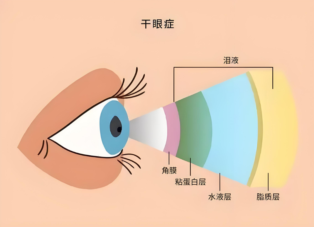 为什么眼睛干涩