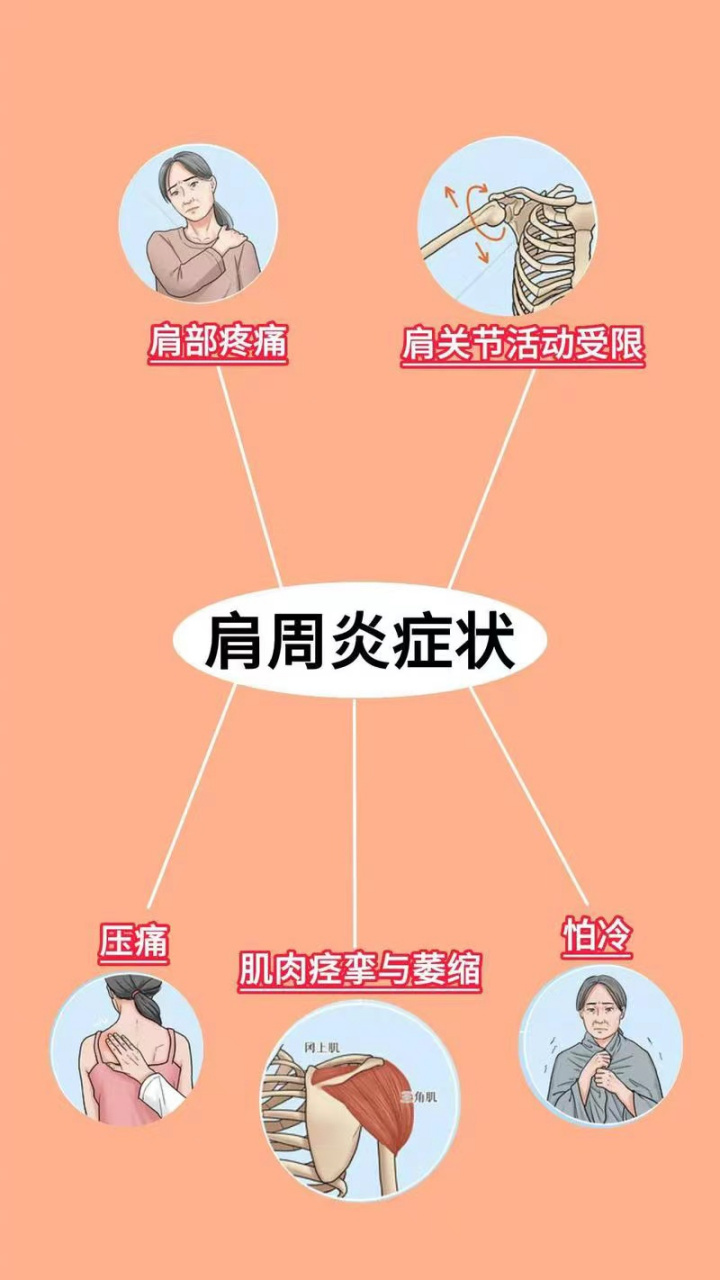 左肩膀痛警惕四种病图片