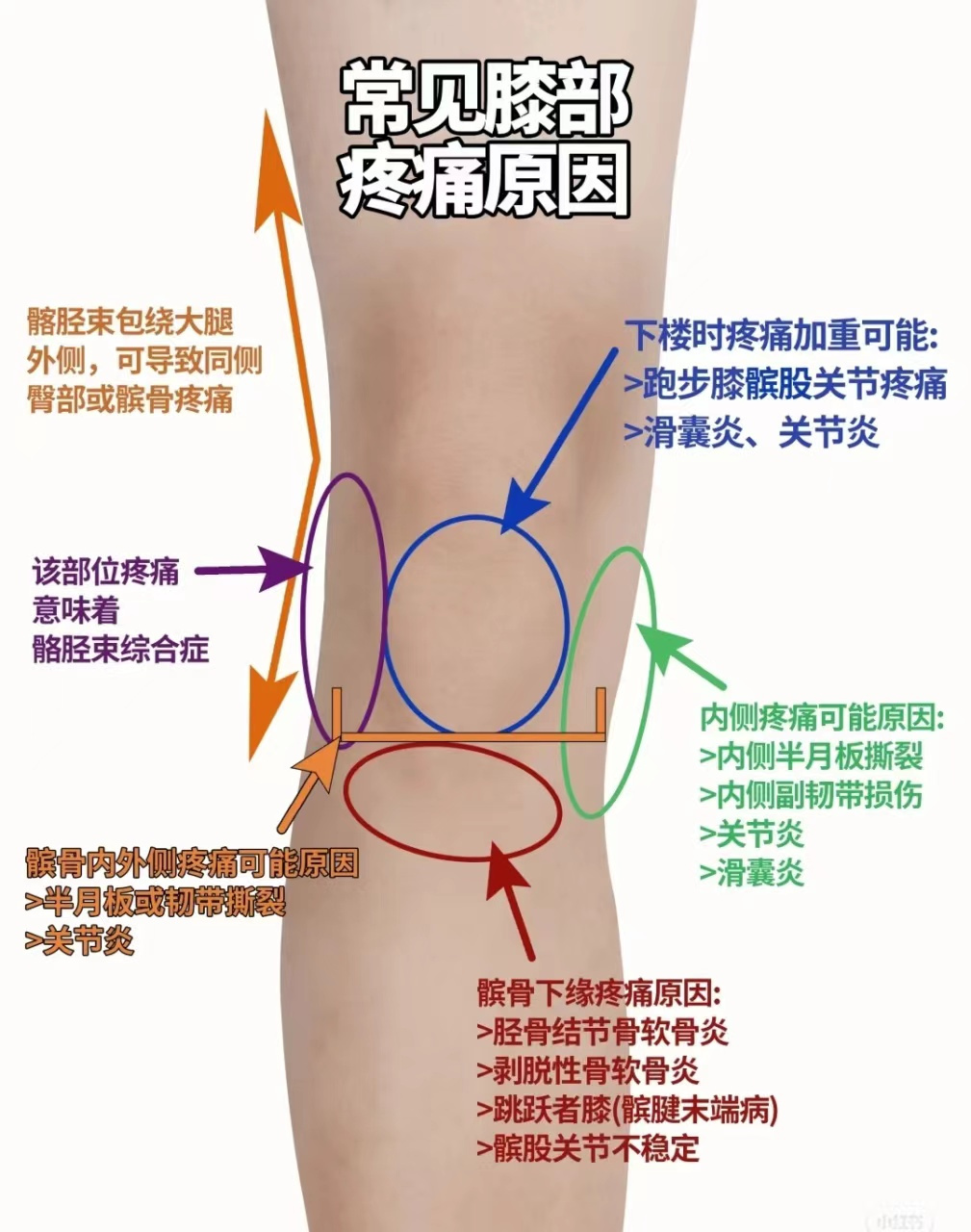 膝盖疼痛对照图图片