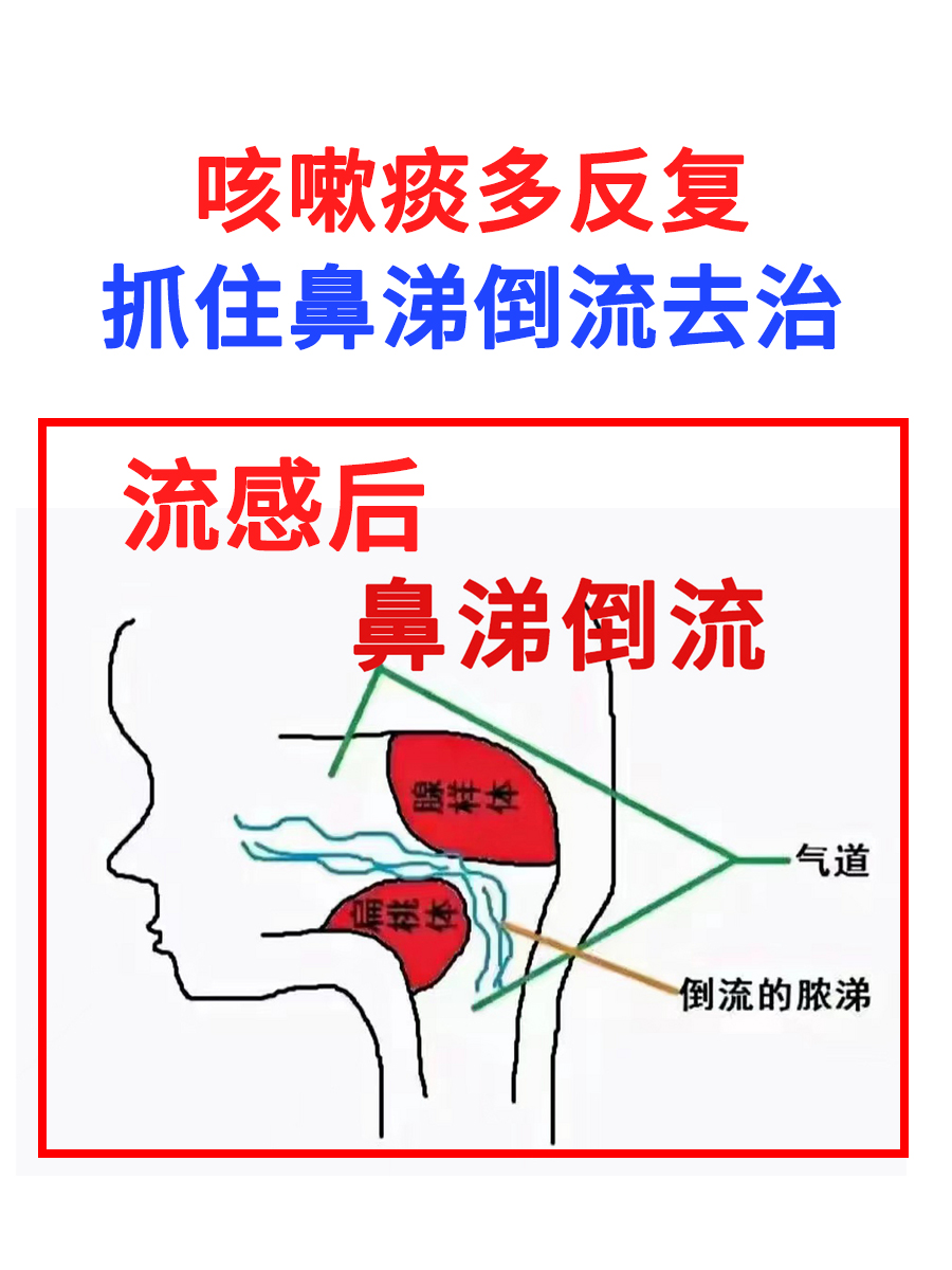 感冒为什么会流鼻涕