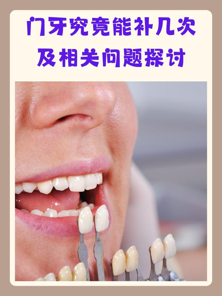 然而,生活中难免会遇到牙齿损伤,需要进行修补