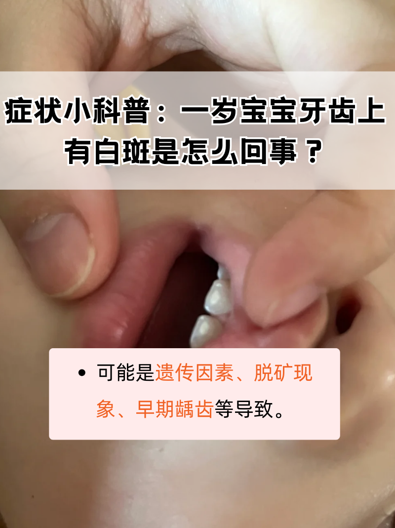 儿童门牙有白斑图片