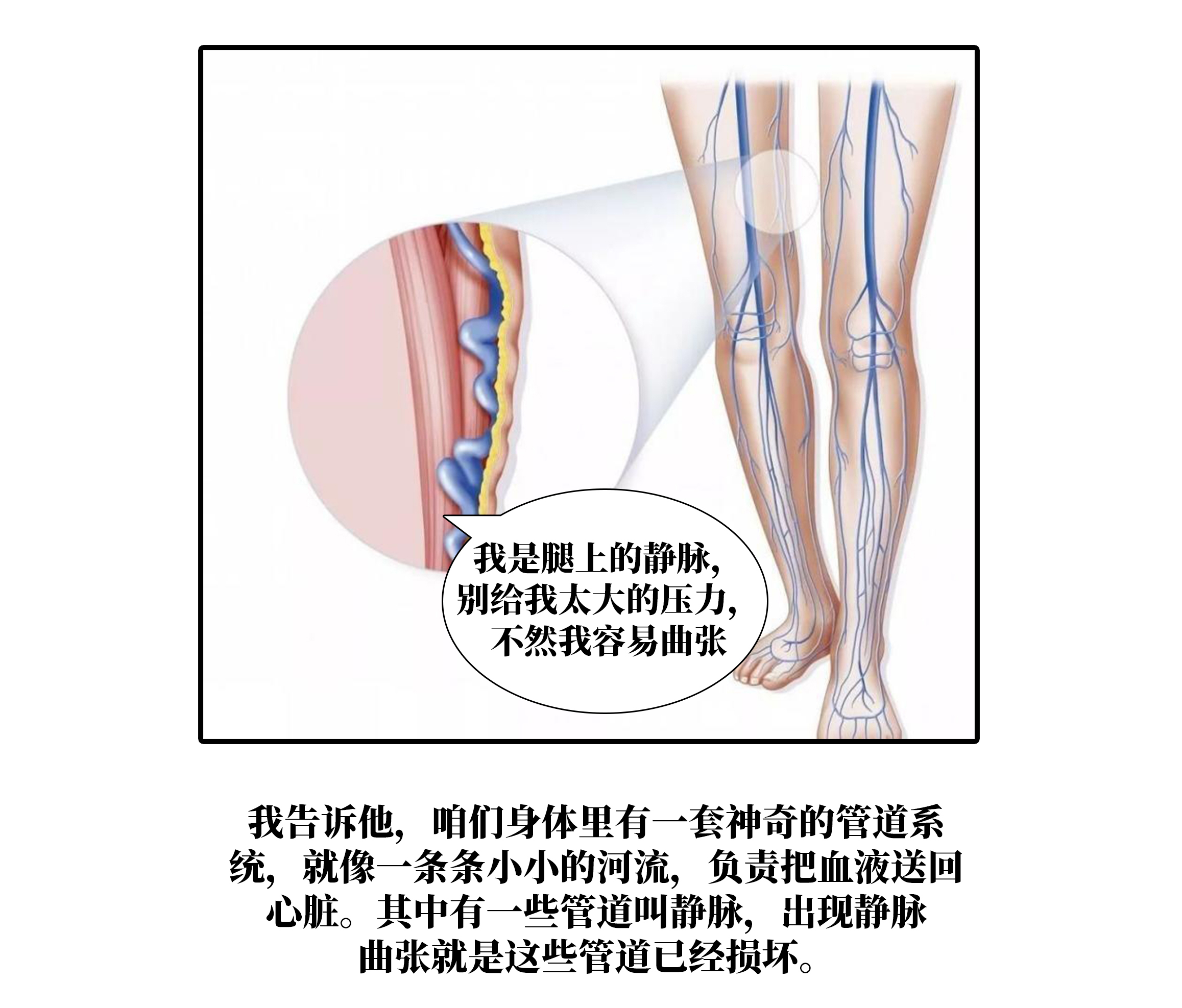 胫前静脉图片