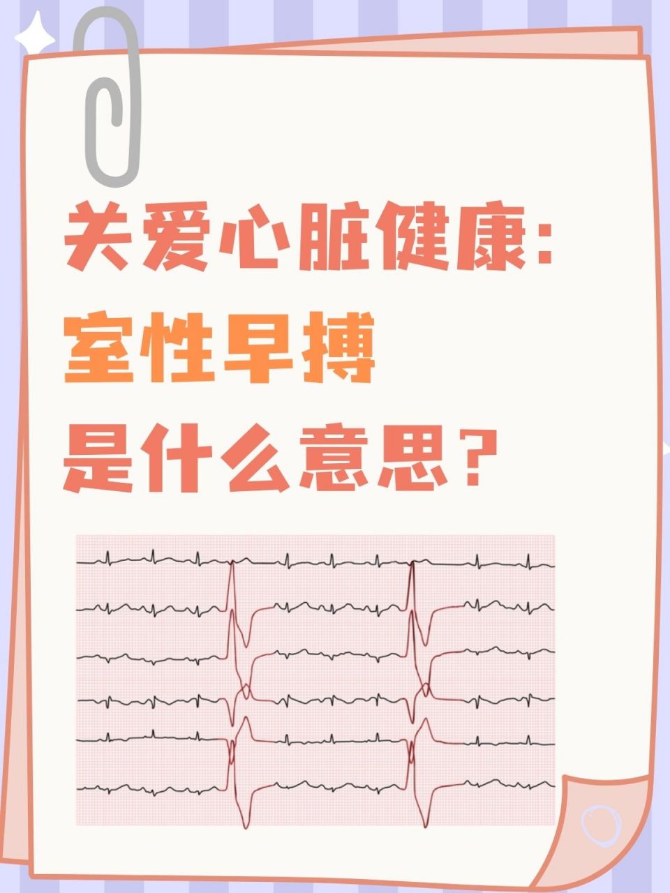 关爱心脏健康:室性早搏是什么意思?