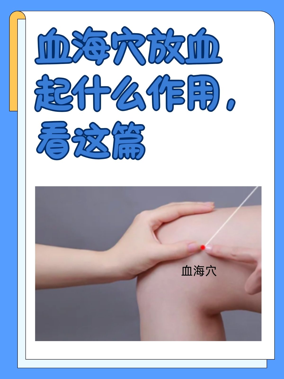 其中,血海穴作为足太阴脾经的重要穴位,通过放血疗法可以发挥多种治疗