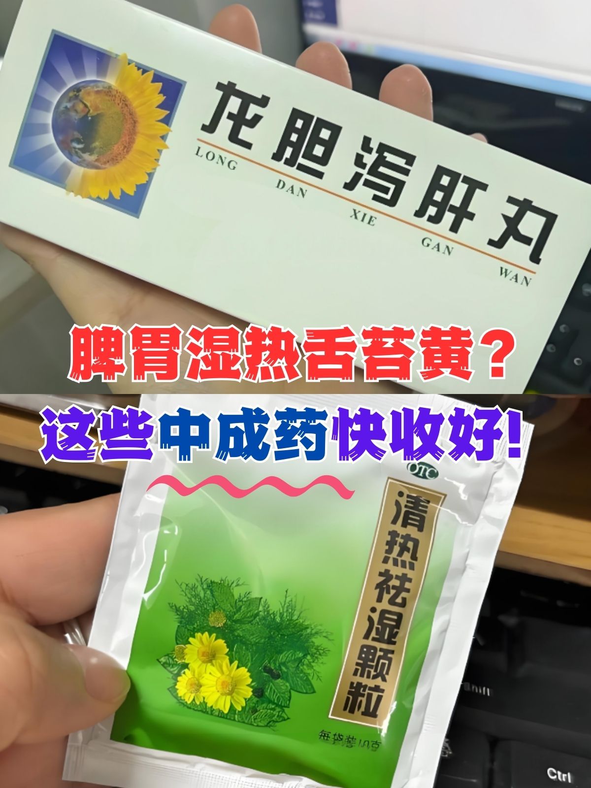 这些中成药快收好! 舌苔黄腻,是中医诊断中脾胃湿热的重要体征之一