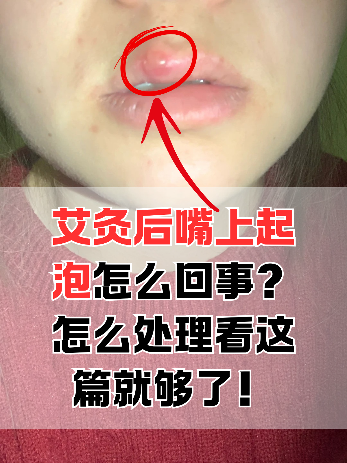 老中医用嘴排毒视频