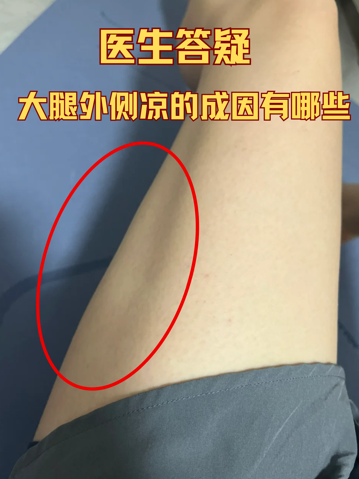 医生答疑:大腿外侧凉的成因有哪些 休息日本来惬意地坐着,却感觉身体
