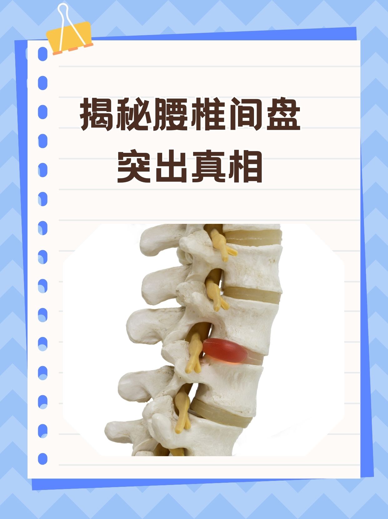 腿部疝气的症状图片图片