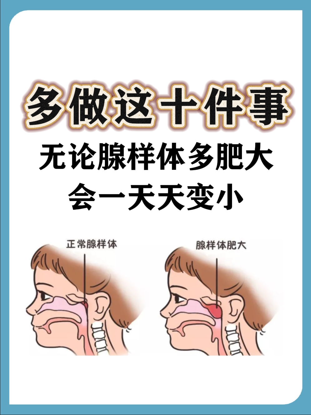 百分之多少10岁腺样体肥大图片和正常图片比较腺样体肥大几岁开始萎缩